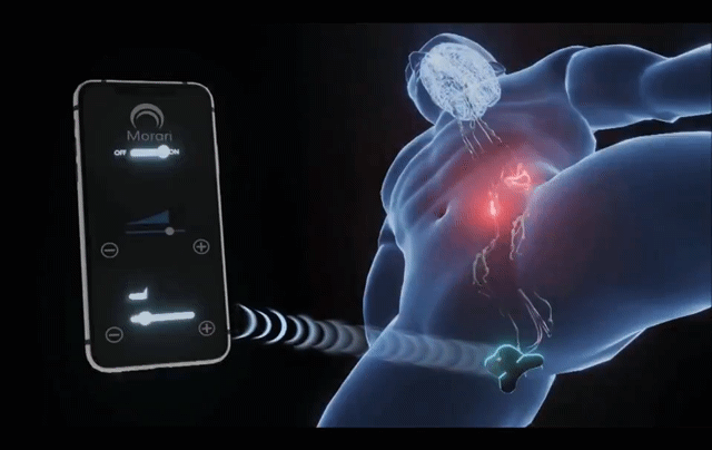 조루증 환자들에게 희소식