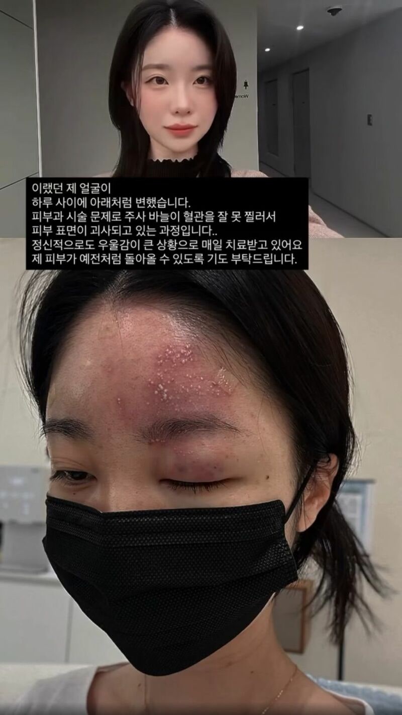 의료사고 당한 여성
