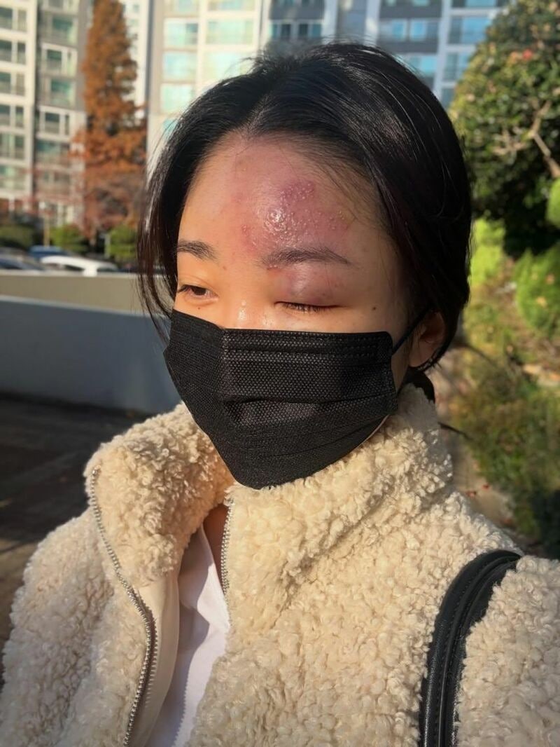 의료사고 당한 여성