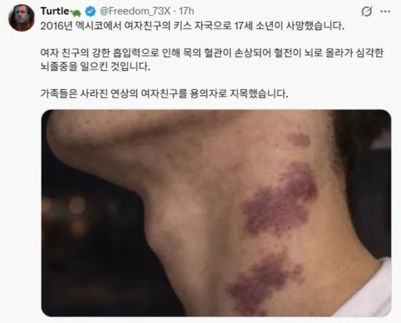 키스를 하면 안되는 이유