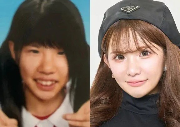2억원치 성형결과