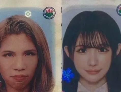 2억원치 성형결과